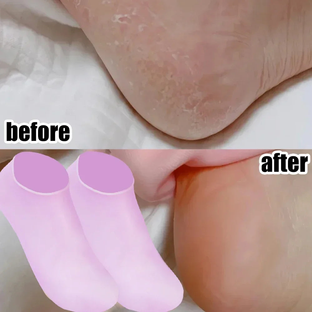 1Pair Silicone Foot Care Socks Anti Cracking Moisturizing Gel Elastic Socks DIY Foot Mask Cracked Dead Skin Remove Pedicure Tool
